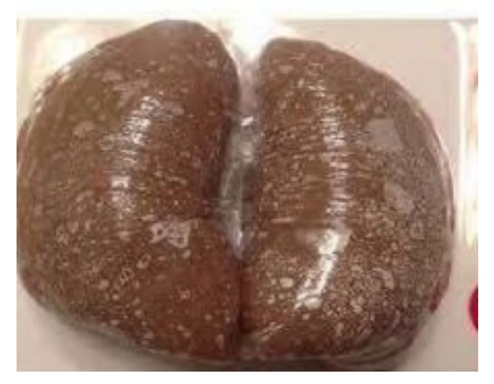Amala.
